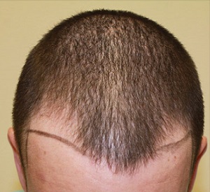 Dr U Hair Clinic