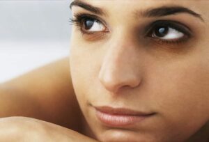 Dark Circles Under The Eye A woman with dark eye circles
