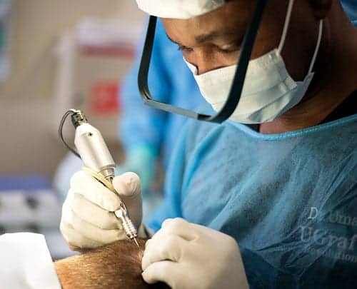 The DrUGraft marked a major breakthrough in hair transplant technology for Asian female hair loss