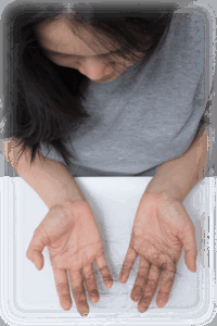 Female Hair Loss - Dr U Hair and Skin Clinic