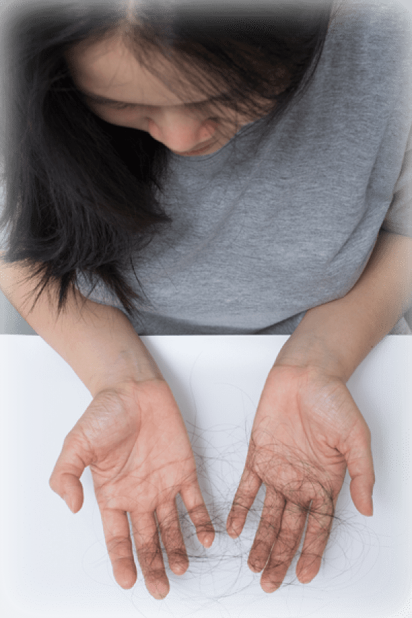 Female Hair Loss - Dr U Hair and Skin Clinic