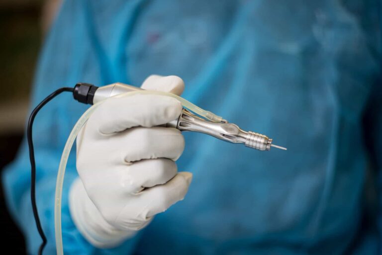 The Dr.UGraft Rotor™ is one of the devices of Dr.UGraft™ set of advanced FUE technologies. It's specialized features make it possible to select more natural caliber donor hairs from the nape and other areas of the body for eyebrow hair restoration surgery. 