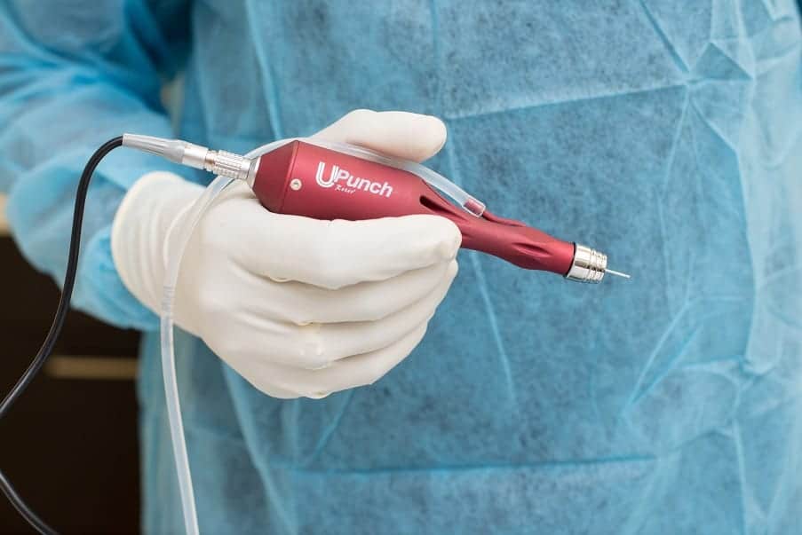 The DrUGraft method and innovative UPunch Rotor tool are part of what make Dr U Hair and Skin Clinic the best FUE hair transplant clinic in the world "<yoastmark