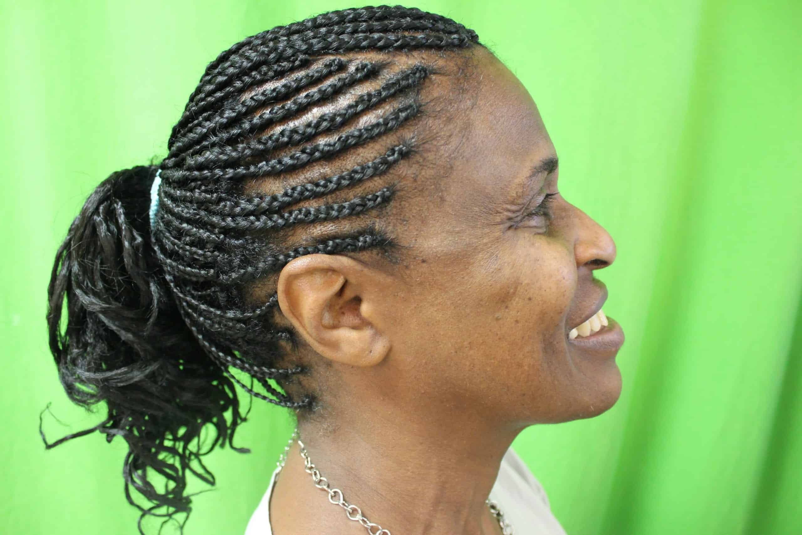 DPN removal healing shows remarkable clearer skin: dpn removal before and after