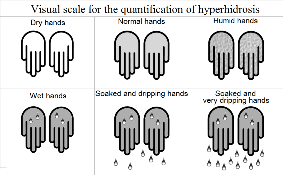 A scale showing the severity levels of Hyperhidrosis. Find Hyperhidrosis treatment at Dr. U Skin Clinic.