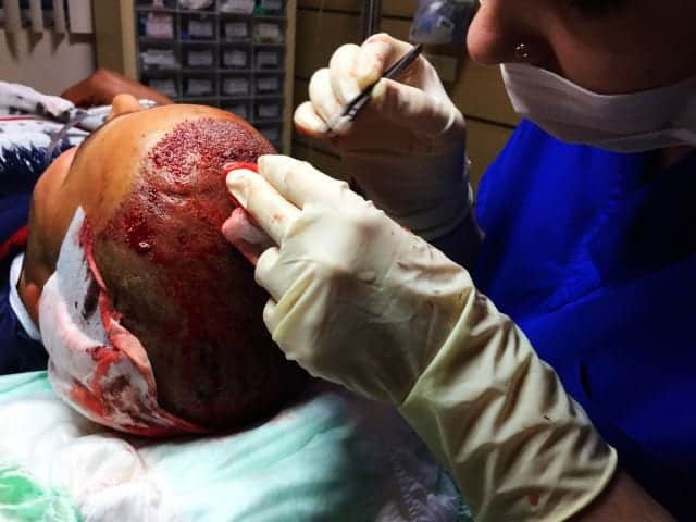 A nurse performing transplant in a clinic in turkey