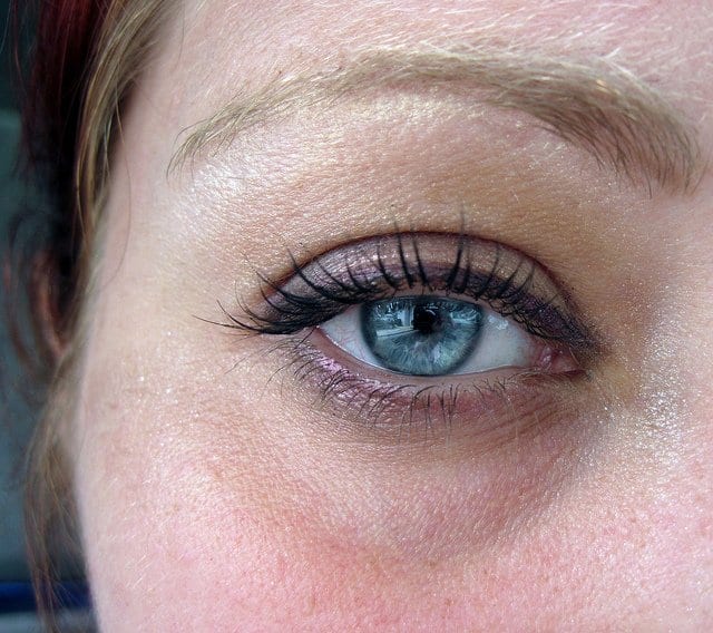 Under Eye Bags and How to Reduce the Appearance of Puffiness