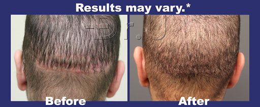 Before and after picture of the patient. 