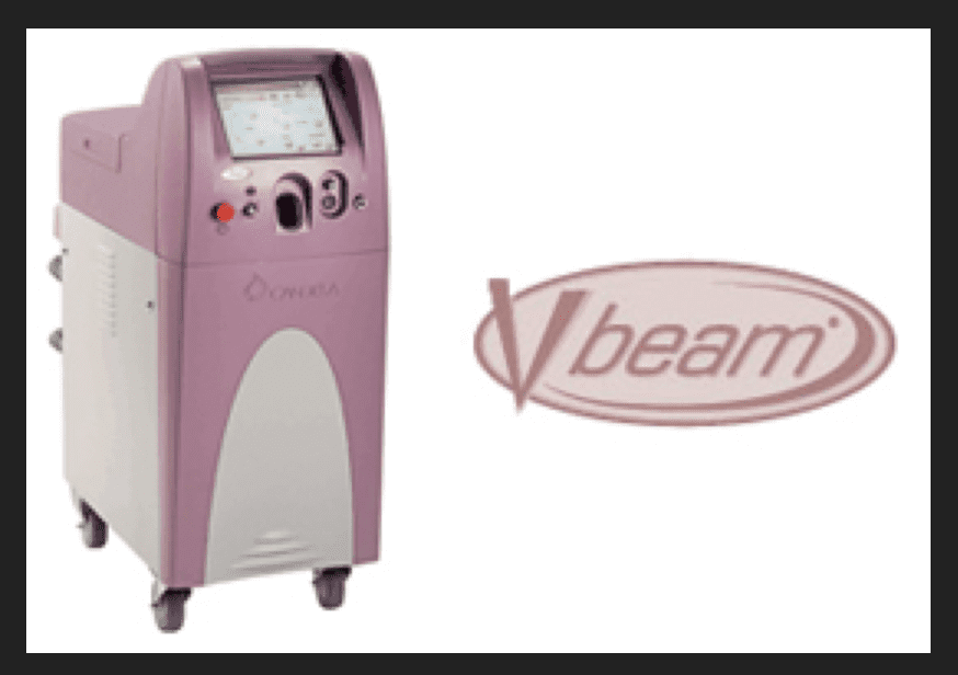 V beam laser by Syneron Candela Company is the industry gold standard for laser treatment of red vascular lesions and is used by Dr U skin clinic of Manhattan Beach Los Angeles