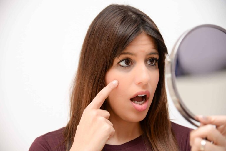 Dark circles under the eyes can be a districting feature on a face, often making a person appear exhausted or ill.*