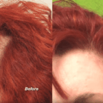 Tension hair loss affects women of all ethnic groups since tight ponytails and harsh grooming habits can contribute to thinning.* Tension hair loss affects women of all ethnic groups since tight ponytails and harsh grooming habits can contribute to thinning.*