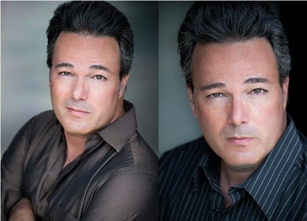 Beverly Hills patient shown 9 years following his hairline reconstruction using leg hair