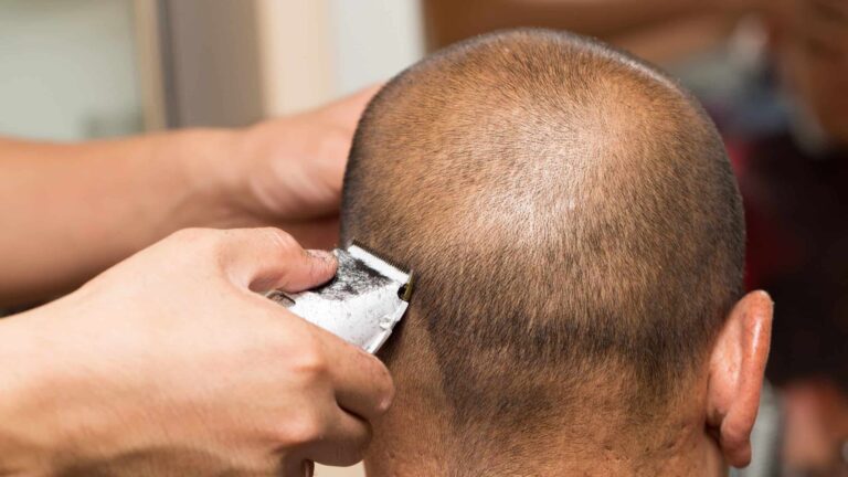 Have you noticed bumps on your head after a shave? While it may be tempting to brush off these bumps as just a barber's rash, they could be symptoms of a skin condition known as AKN.