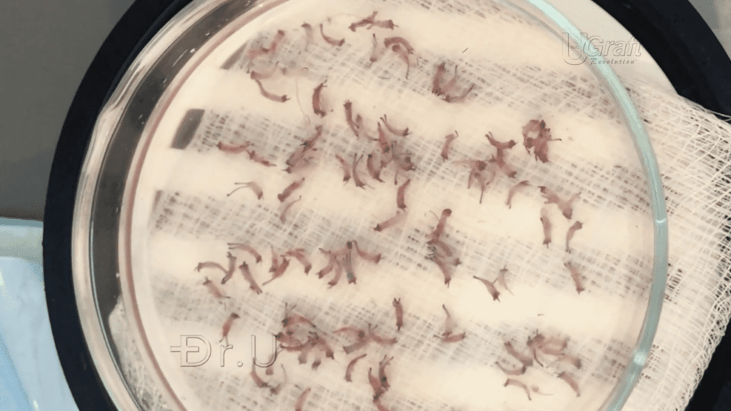 Healthy afro-textured grafts extracted with Dr. UGraft™'s sonic FUE technology.*