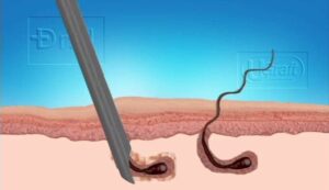 Dr.UPunch Following the Curve of Afro-Textured Hair*
