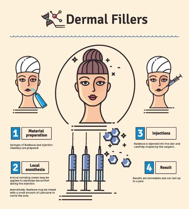 Prior to injection, a numbing cream is applied. The dermal filler is then expertly injected, in this case for the best non surgical cheek lift, and then shaped.