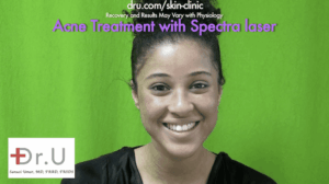 The patient is happy with her Spectra laser skin acne treatment at Dr. U Skin Clinic.