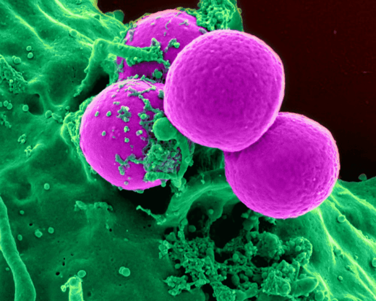 immunotherapy, for Manhattan Beach patients, is a newer form of skin cancer treatment which enhances our immune system's ability to kill cancer cells.