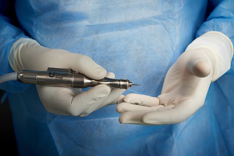 The Dr.UPunch i™ has revolutionized the world of FUE hair transplant.