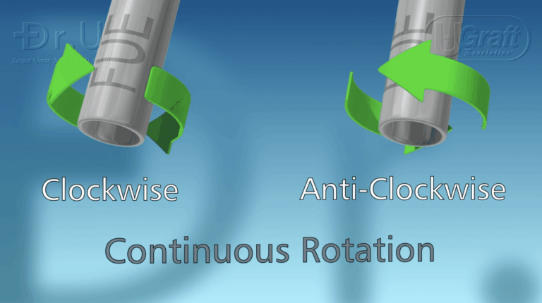 Rotary FUE punches can turn either clockwise or counter-clockwise.