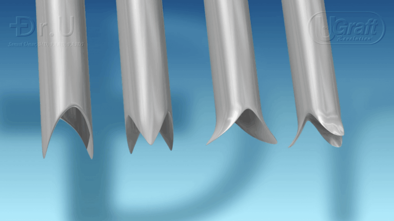 Different types of FUE hair transplant tools can be used for different types of patients.