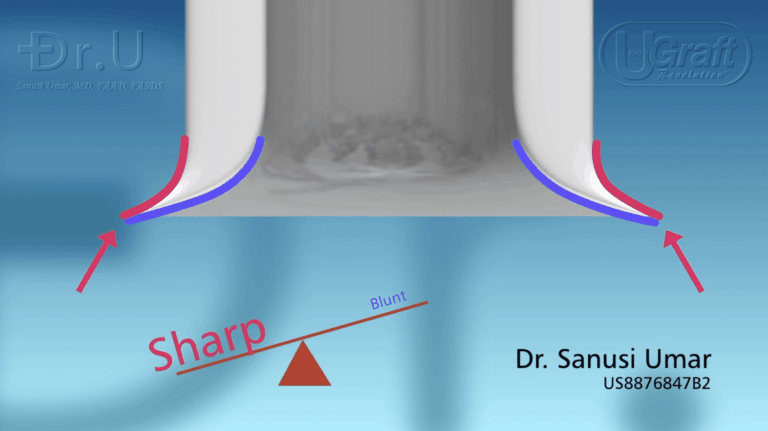 This hybrid FUE punch tip tends more to the sharper end of the continuum.