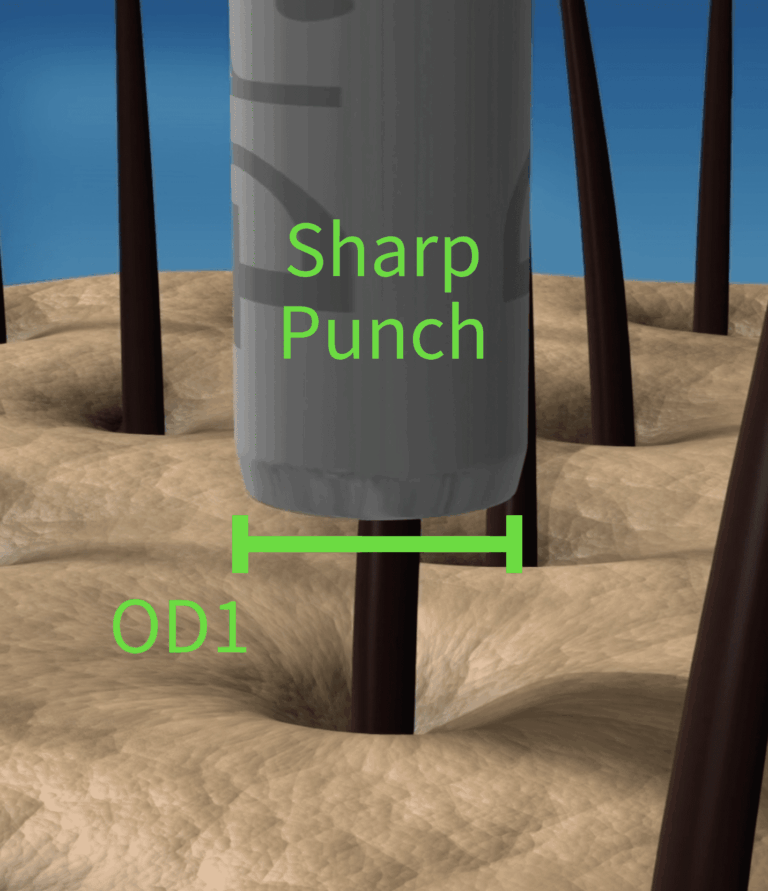 A small, sharp punch makes the initial incision around the graft.