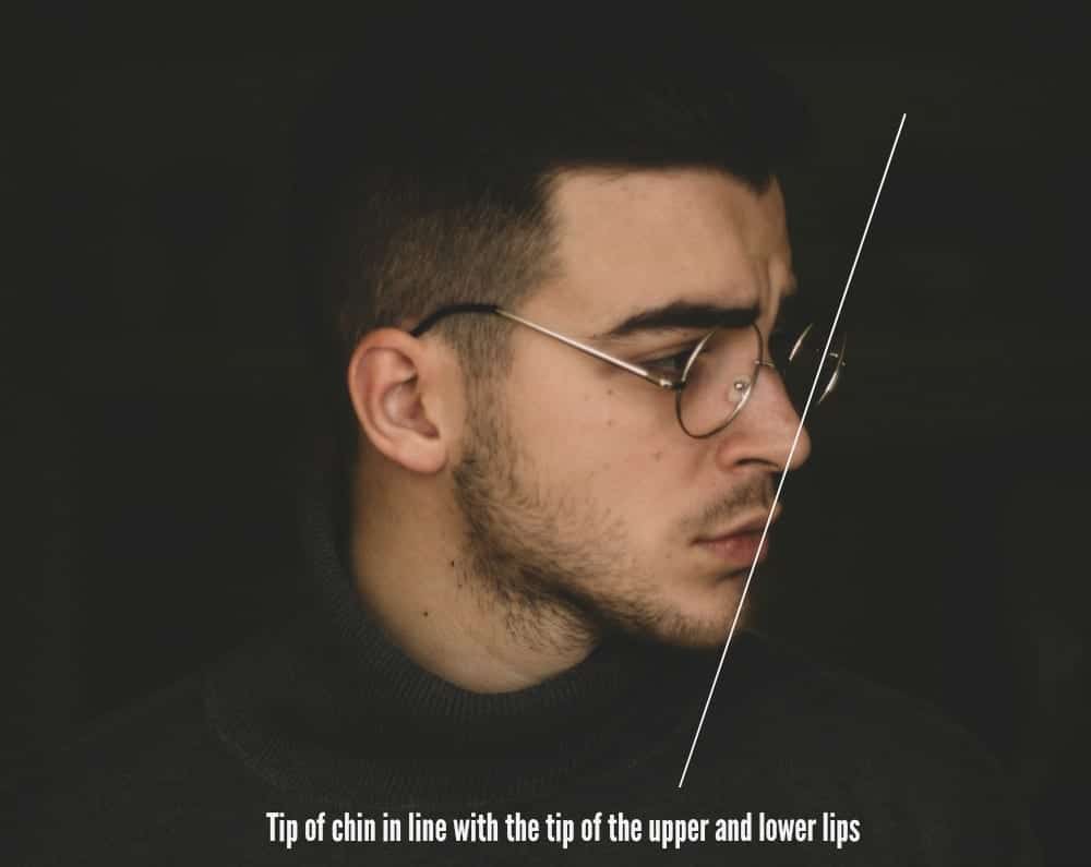 Surgical and non-surgical chin augmentation aims for more classic lower facial proportions.