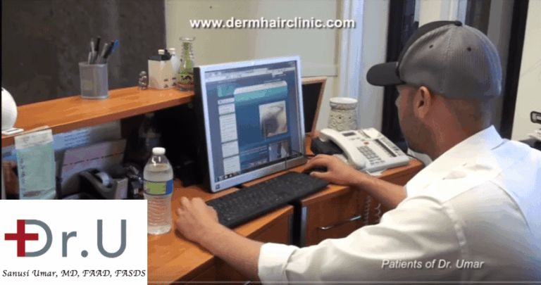 Ask lots of questions as you conduct your own research to learn more about the hair transplant process, 
