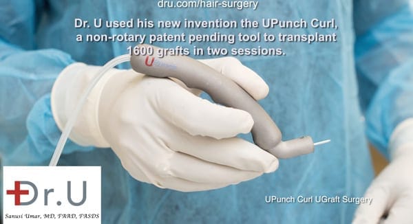The innovation of the DrUPunch Curl was a breakthrough in FUE hair restoration in black African men The innovation of the DrUPunch Curl was a breakthrough in FUE hair restoration for black African men