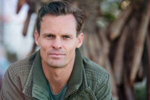 Both men and women in Los Angeles with mild to moderate skin elasticity can qualify for FaceTite procedures