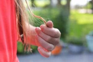 How Do Doctors Diagnose Hair Loss Types?