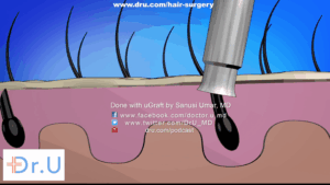 Dr. UGraft™