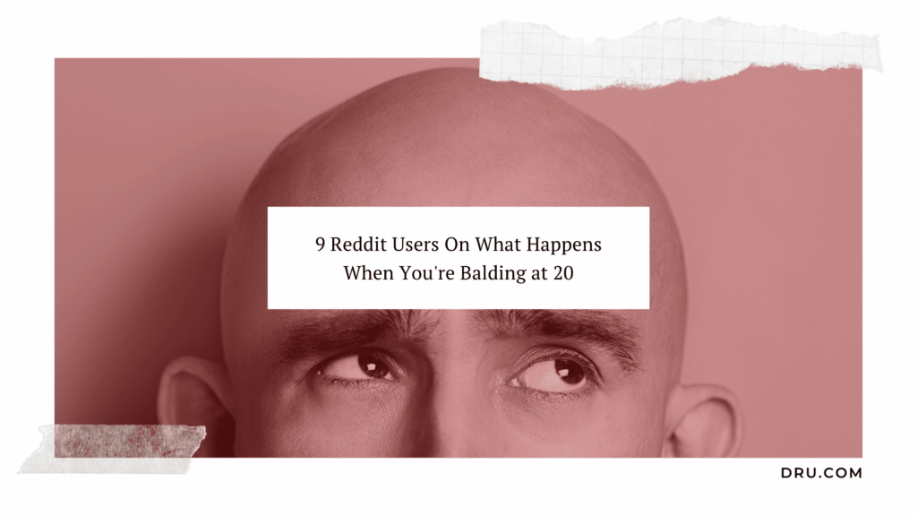 Balding at 20 - Redditors and their experiences