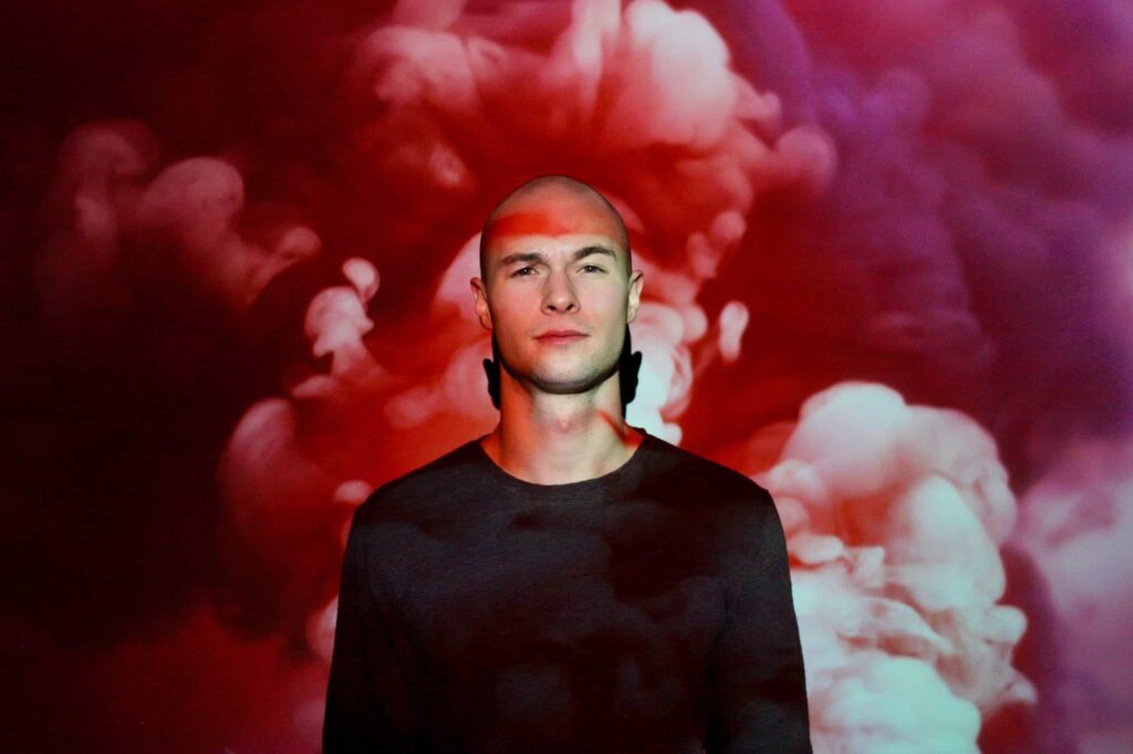 balding at 20