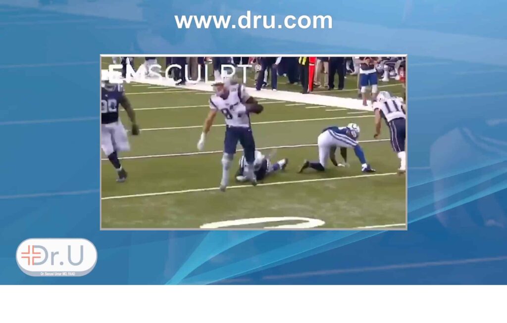 Rob Gronkowski uses Emsculpt to help him achieve the fitness level needed as a professional player