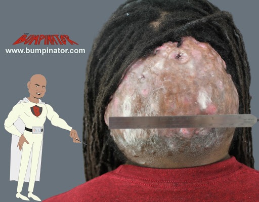 Mike’s massive AKN bump.