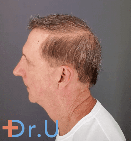 NW 7 Restoration Dr. U