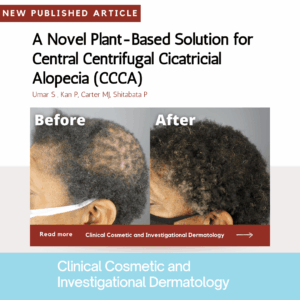 In a recently published peer-review journal, Clinical Cosmetic and Investigational Dermatology, Dr. UGro GASHEE Botanical Products have been proven to help alleviate the symptoms of CCCA (Central centrifugal cicatricial alopecia).*