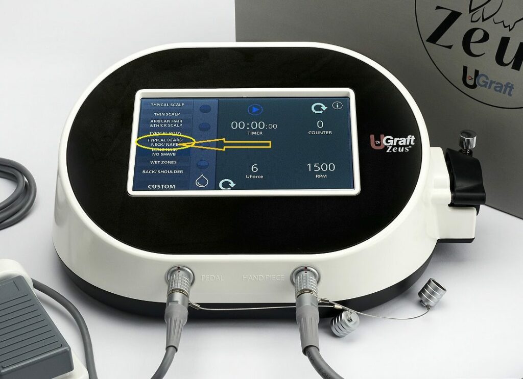 The New UGraft Zeus System has several presets, such as nape hair, tailored for FUE extraction of nape hair. With this new technology, BHT (Body Hair Transplant) and nape hair transplant have become much more feasible. Nape Hair Extraction Setting in UGraft Zeus