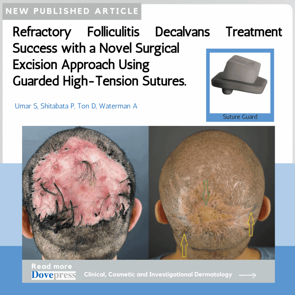 The noteworthy study was published in the Clinical, Cosmetic and Investigational Dermatology Journal.