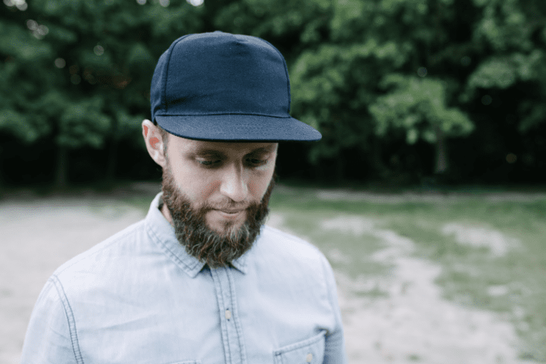 Wearing hats and SPF protection on high UV days adds additional protection to the scalp.