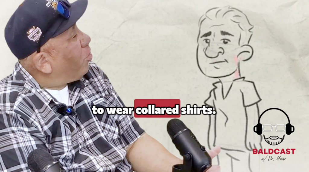 Collared shirts are what helped Robert to hide the first physical symptoms of his hairline bumps.