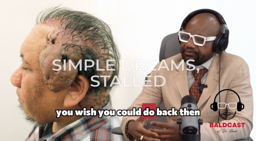 Dr. Sanusi Umar asks Robert about his dreams and aspirations while living a life with severe hairline bumps.