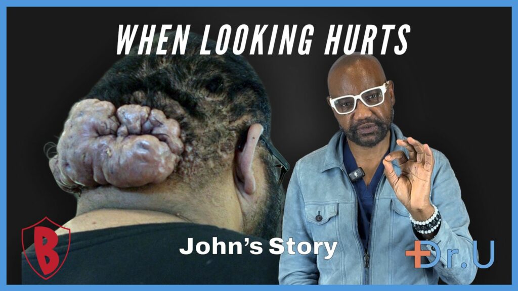From the Cliff’s Edge to Scalp Healing: John’s Transformation