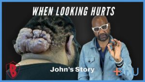 From the Cliff’s Edge to Scalp Healing: John’s Transformation