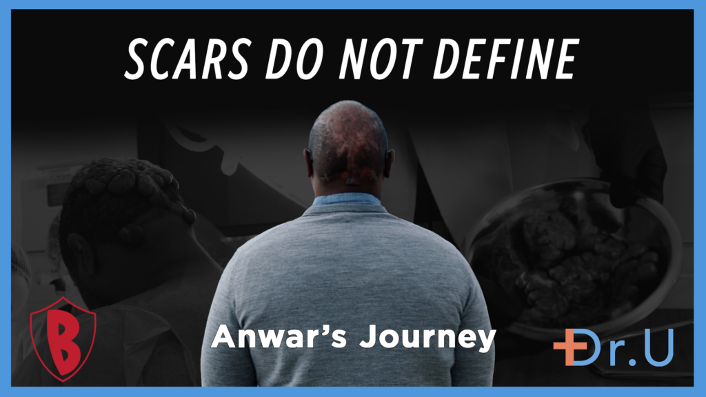 scars do not define