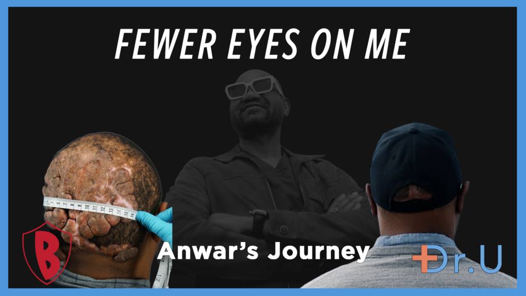 fewer eyes on me