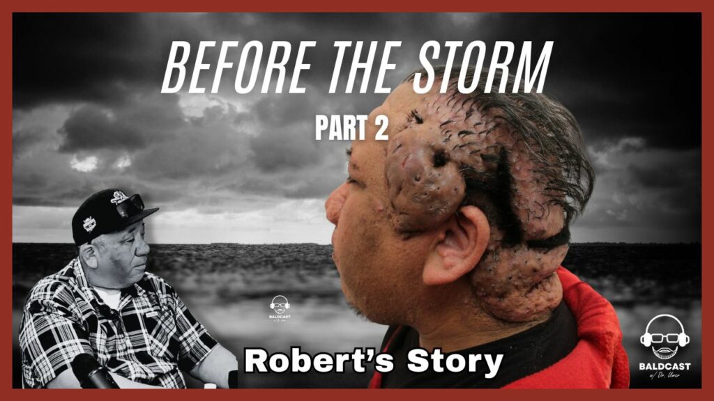 before the storm part 2