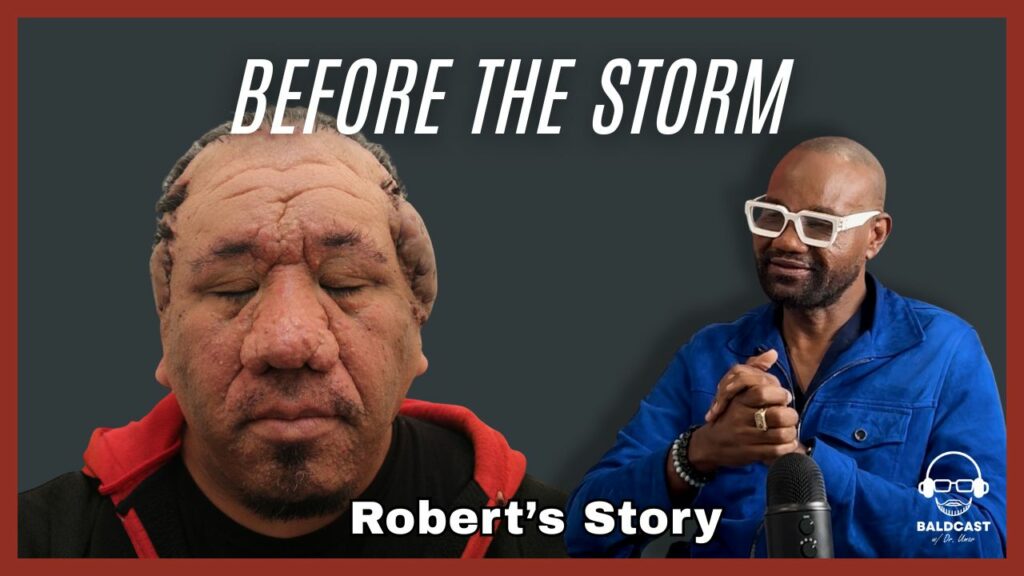 before the storm